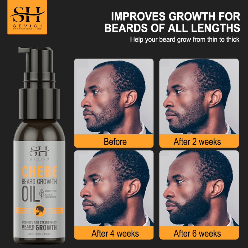 Sevich Men Beard Growth Essent - Hair Care For Men のレビューと価格