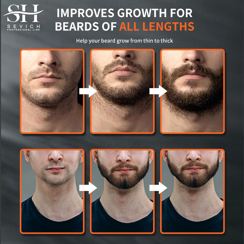 Sevich Men Beard Growth Essent - Hair Care For Men のレビューと価格