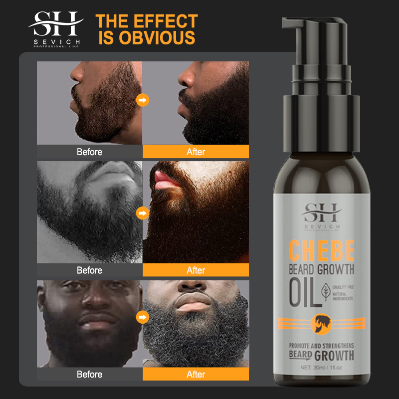 Sevich Men Beard Growth Essent - Hair Care For Men のレビューと価格