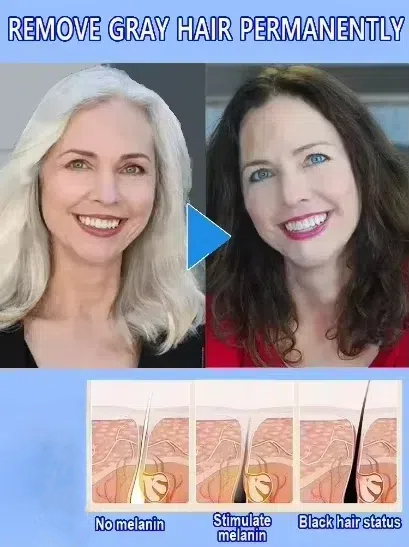 White hair killer, remove gray - Hair Care Natural Products のレビューと価格