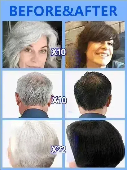 White hair killer, remove gray - Hair Care Natural Products のレビューと価格