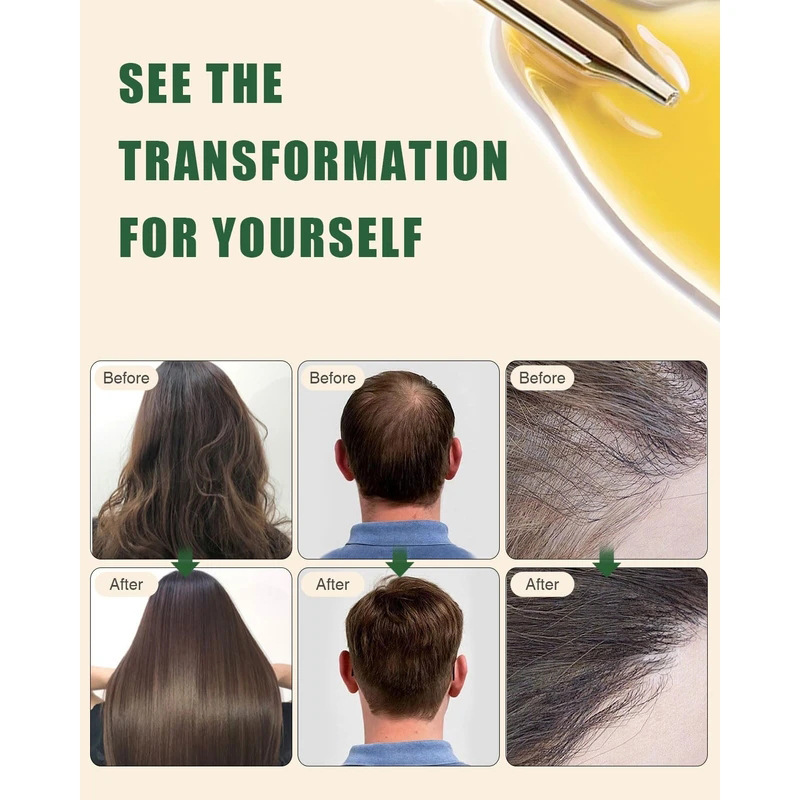 Batana Rosemary Hair Care Esse - Hair Care Products のレビューと価格