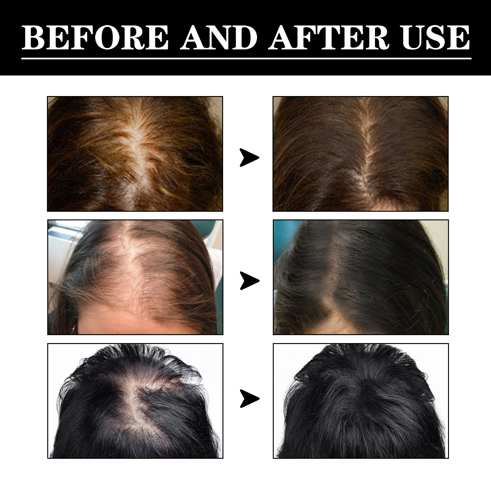 Hair care essence has good per - Hair Care Good Hair のレビューと価格