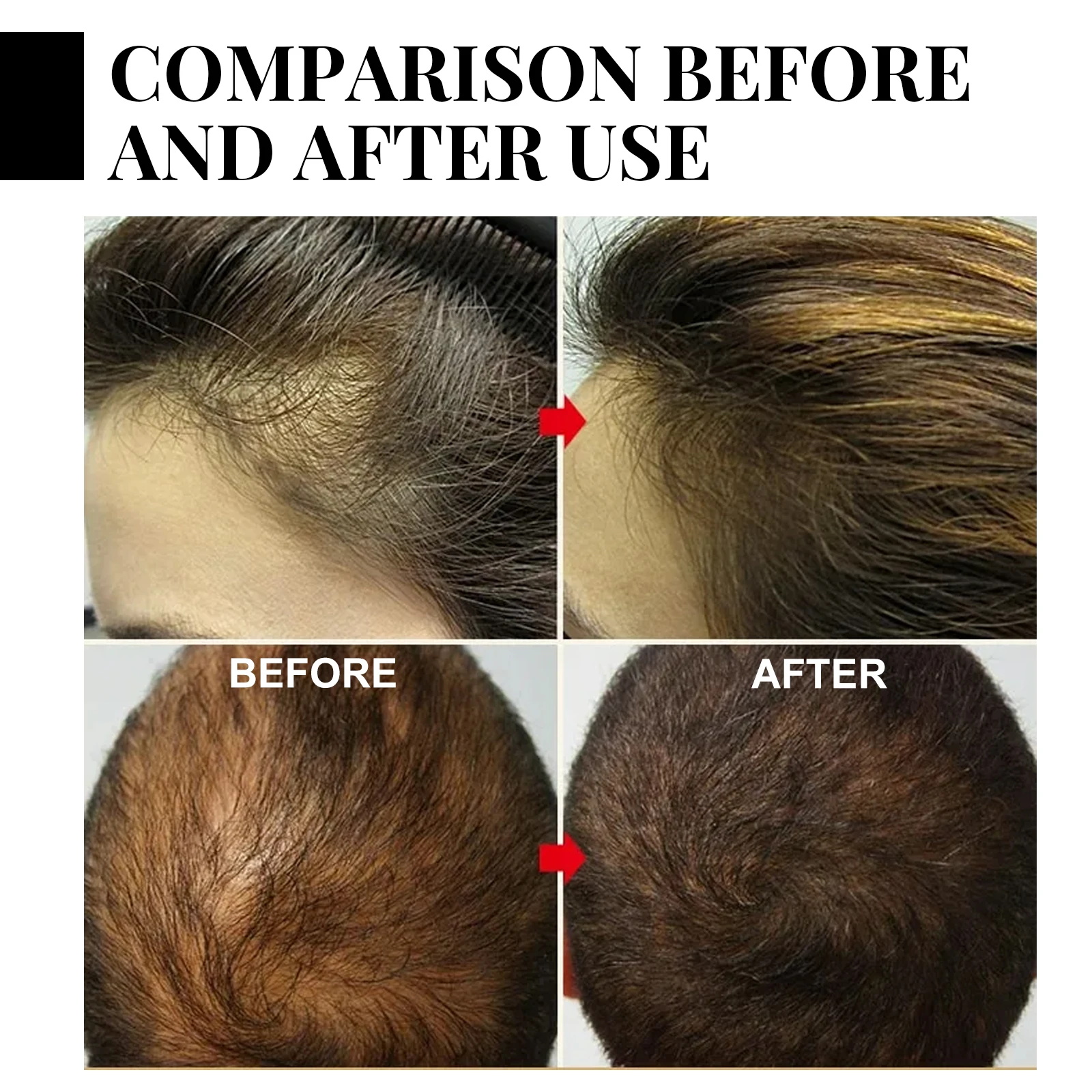 Ginger Hair Growth spray Anti  - Hair Care Natural Products のレビューと価格