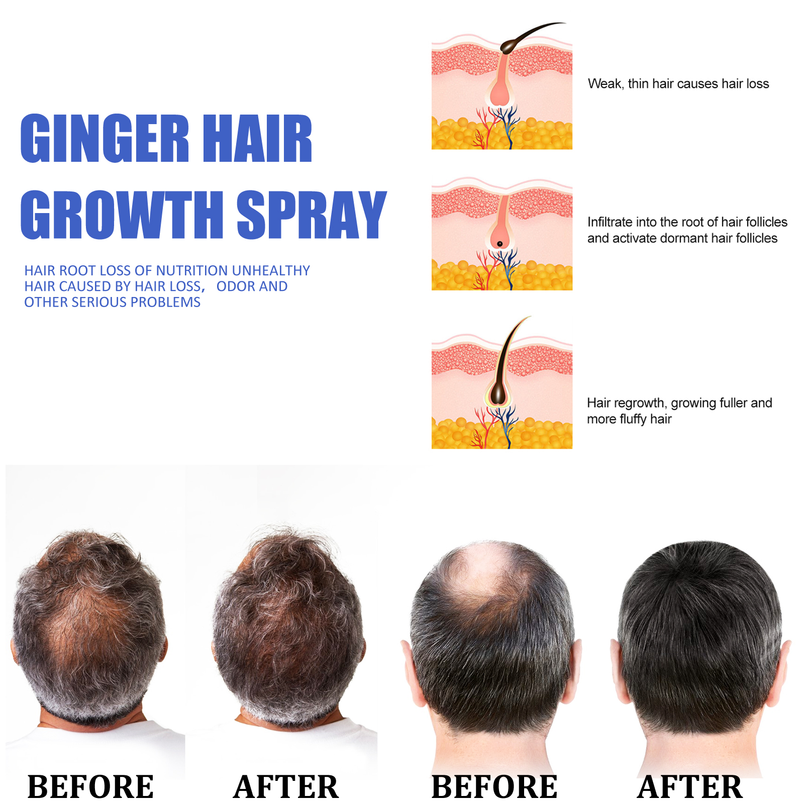 Ginger Hair Growth spray Anti  - Hair Care Natural Products のレビューと価格