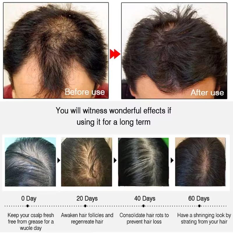 Ginger Hair Growth spray Anti  - Hair Care Natural Products のレビューと価格